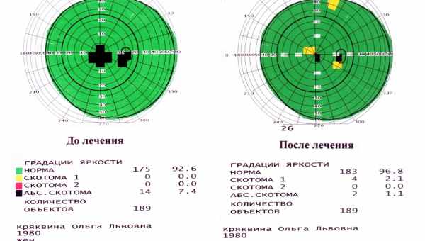 Ограничение поля зрения назвали средством от тошноты в виртуальной реальности